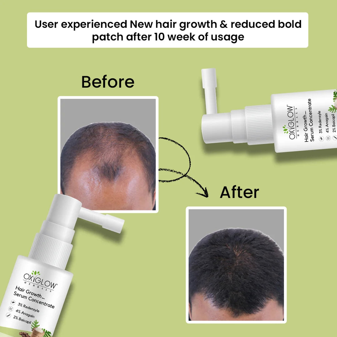 OxyGlow Herbals Hair Growth Serum Concentrate 30 ml
