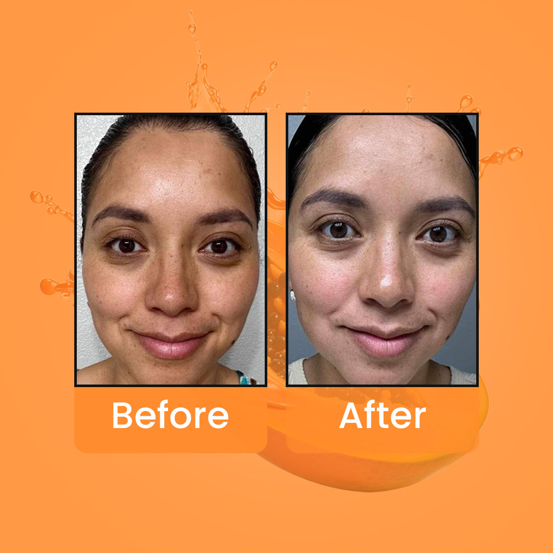 OxyGlow Herbals Papaya Bleach Cream Before After